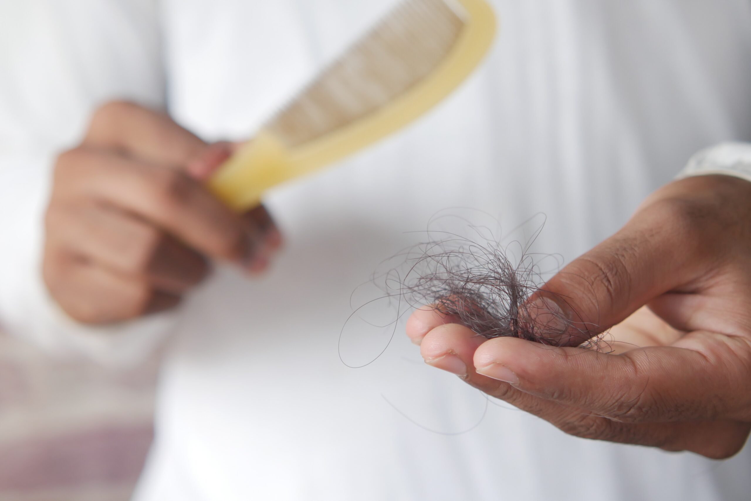 Trying to cope up with Hair-fall?